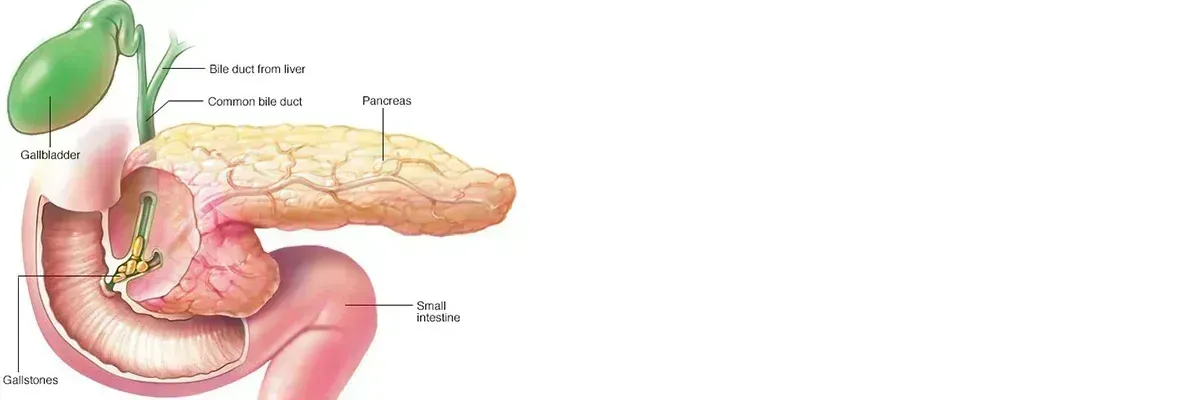 PANCREATIC DISEASES